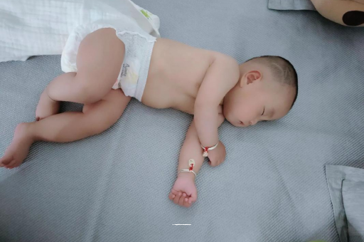 齐齐哈尔宝宝头上长痱子